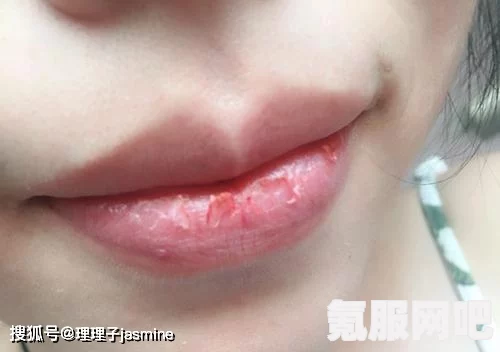 水蜜桃唇蜜嘟嘟唇是三无产品吗？如何辨别安全可靠的唇部护理产品，教你识别优质护唇品的方法与技巧