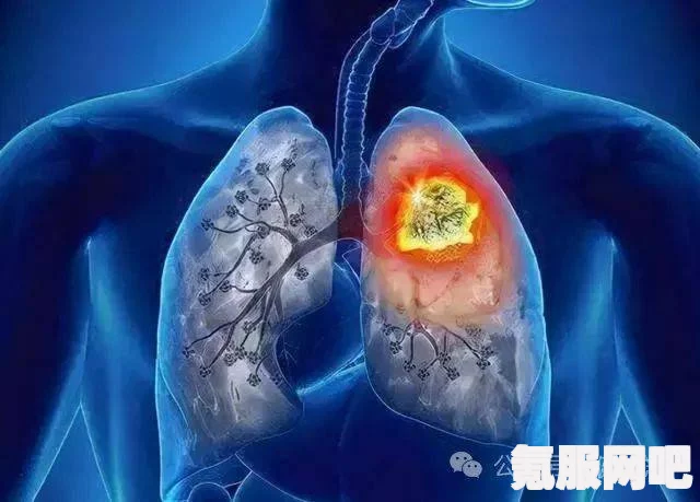 翼星求生肺病的治疗方法，探索有效的治疗途径